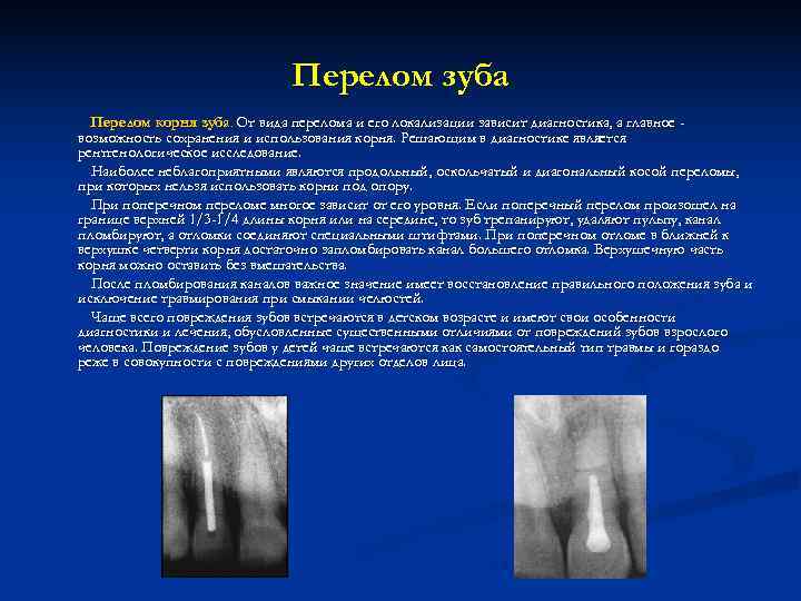 Перелом корня зуба презентация