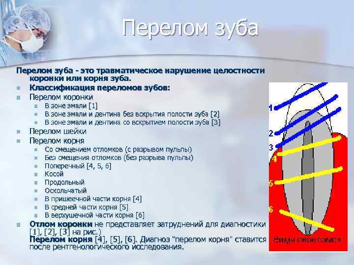 Открытый перелом мкб. Перелом зуба классификация. Классификация трещин зуба.