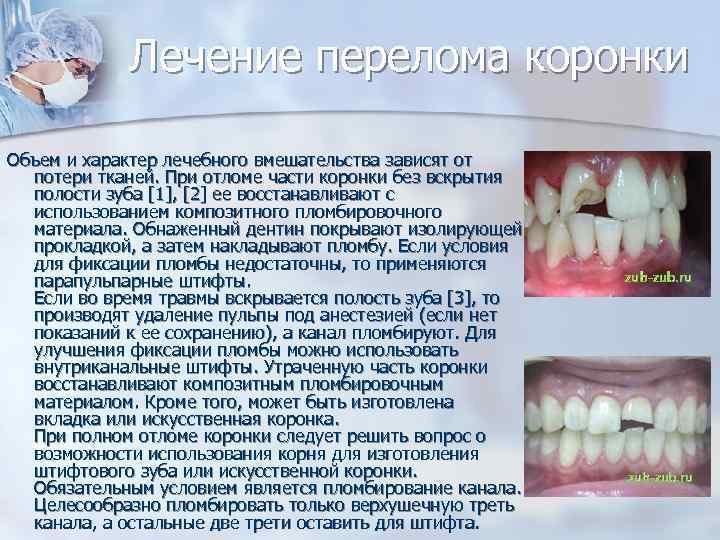    Лечение перелома коронки  Объем и характер лечебного вмешательства зависят от