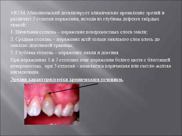 ØЮ. М. Максимовский детализирует клинические проявление эрозий и различает 3 степени поражения, исходя из