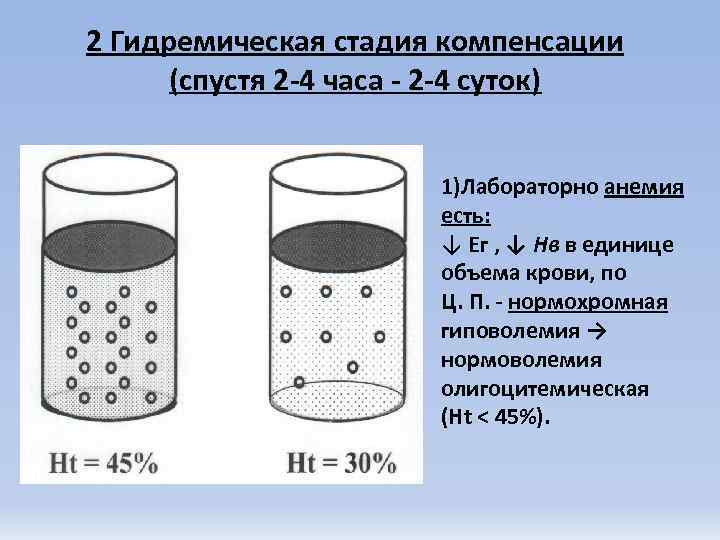 2 Гидремическая стадия компенсации  (спустя 2 -4 часа - 2 -4 суток) 