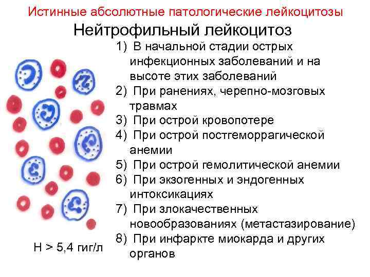 Лейкозы презентация терапия