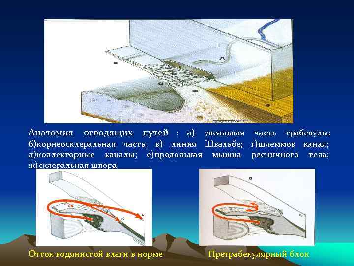 Анатомия  отводящих  путей : а) увеальная часть трабекулы; б)корнеосклеральная часть; в) линия