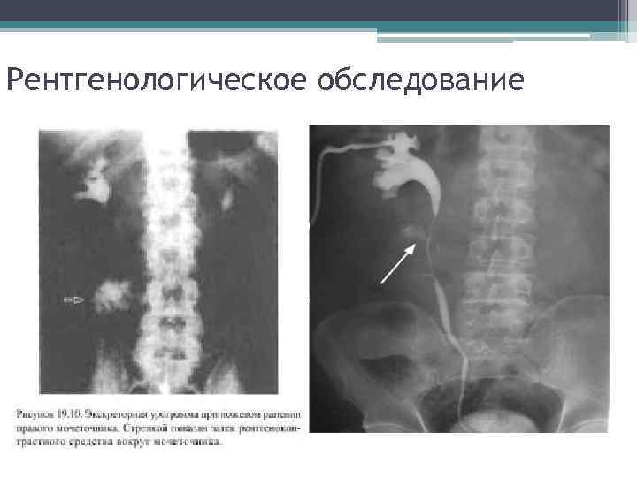 Рентгенологическое обследование 