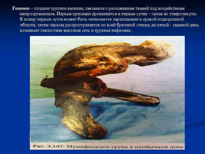 Гниение – позднее трупное явление, связанное с разложением тканей под воздействием  микроорганизмов. Первые