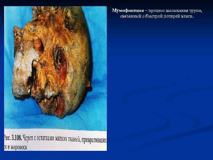 Мумификация – процесс высыхания трупа,  связанный с быстрой потерей влаги. 
