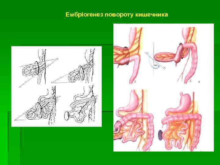 Ембріогенез повороту кишечника 