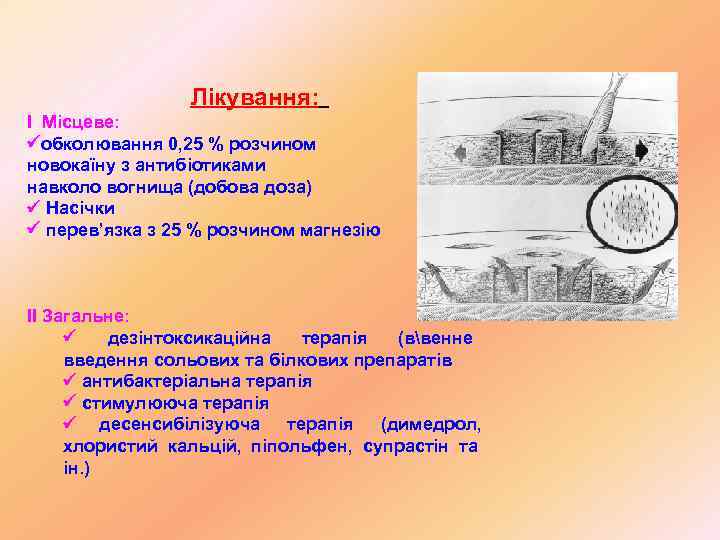    Лікування: І Місцеве:  обколювання 0, 25 % розчином новокаїну з