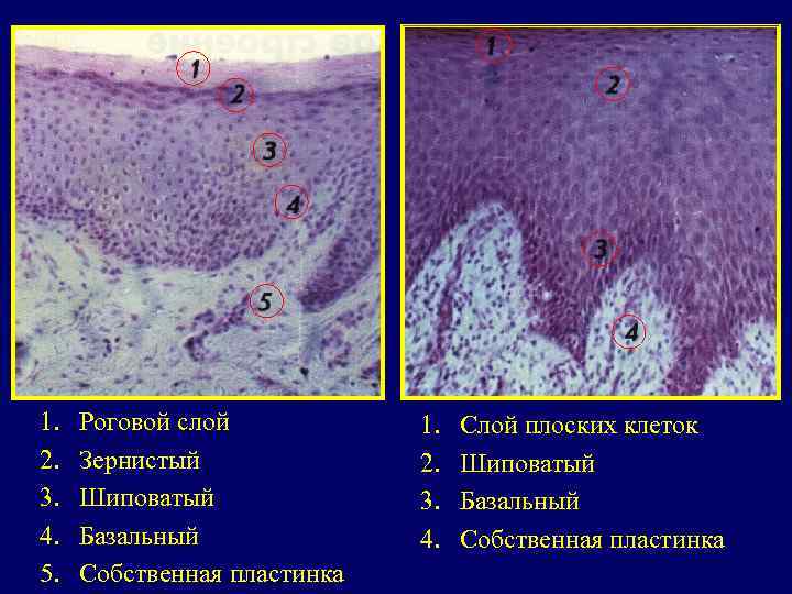 1.  Роговой слой  1.  Слой плоских клеток 2.  Зернистый 