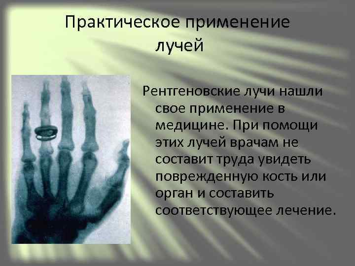 Практическое применение  лучей   Рентгеновские лучи нашли  свое применение в 