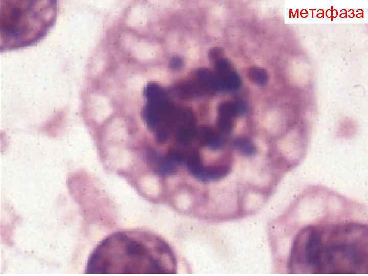 метафаза метафаза