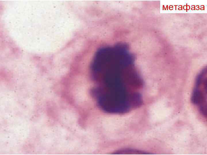 метафаза метафаза