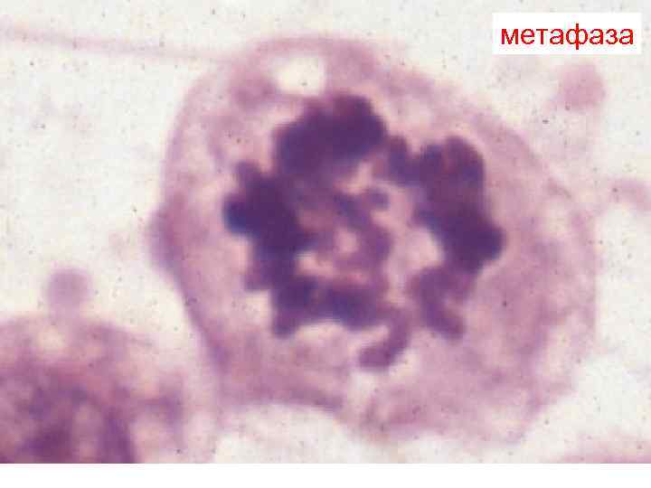 метафаза метафаза