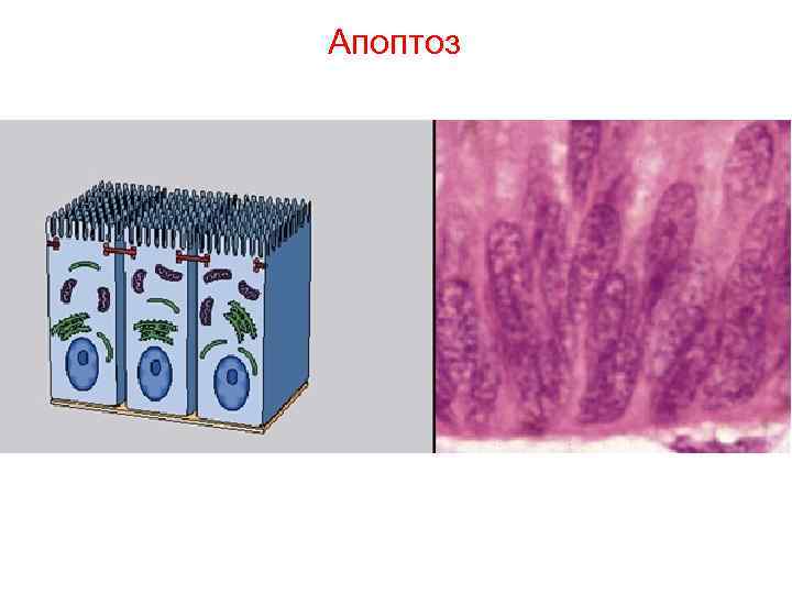 Апоптоз Апоптоз