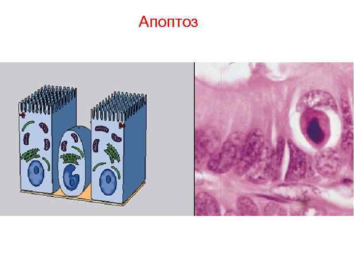 Апоптоз Апоптоз