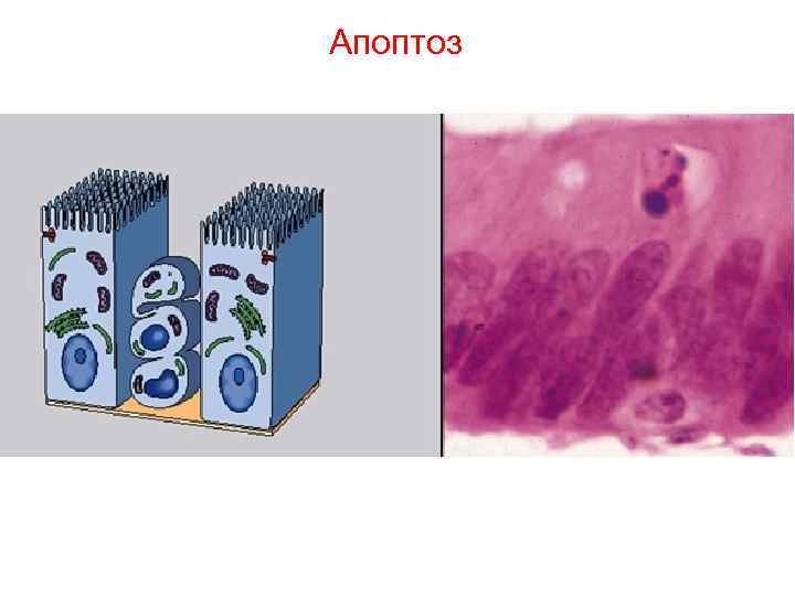 Апоптоз Апоптоз