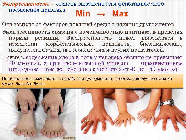 Экспрессивность – степень выраженности фенотипического проявления признака Min → Max Она зависит от факторов