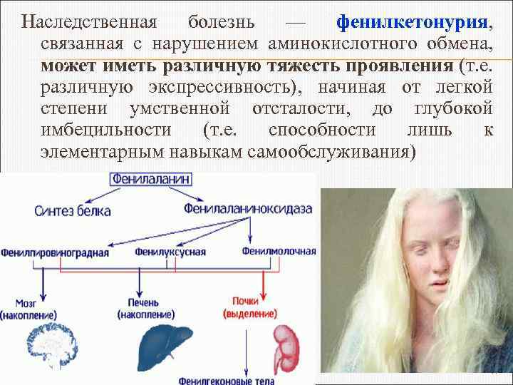 Наследственная болезнь — фенилкетонурия, связанная с нарушением аминокислотного обмена, может иметь различную тяжесть проявления
