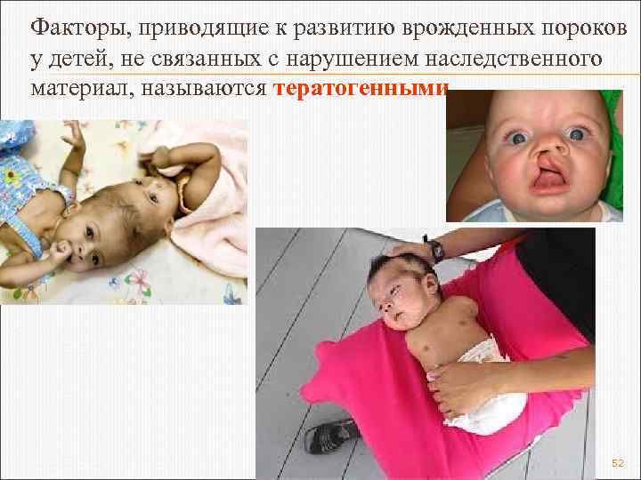 Факторы, приводящие к развитию врожденных пороков у детей, не связанных с нарушением наследственного материал,