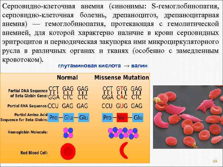 Серповидно-клеточная анемия (синонимы: S-гемоглобинопатия, серповидно-клеточная болезнь, дрепаноцитоз, дрепаноцитарная анемия) — гемоглобинопатия, протекающая с гемолитической