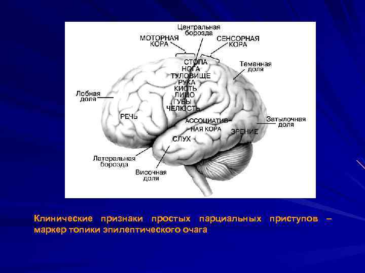 Клинические признаки простых парциальных приступов – маркер топики эпилептического очага 