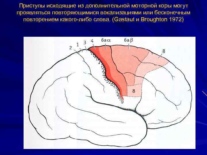 Приступы исходящие из дополнительной моторной коры могут проявляться повторяющимися вокализациями или бесконечным повторением какого-либо