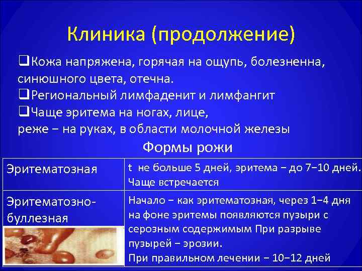   Клиника (продолжение) q. Кожа напряжена, горячая на ощупь, болезненна,  синюшного цвета,