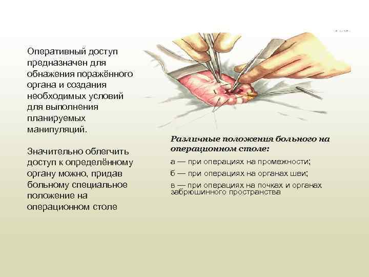 Оперативный доступ предназначен для обнажения поражённого органа и создания необходимых условий для выполнения планируемых