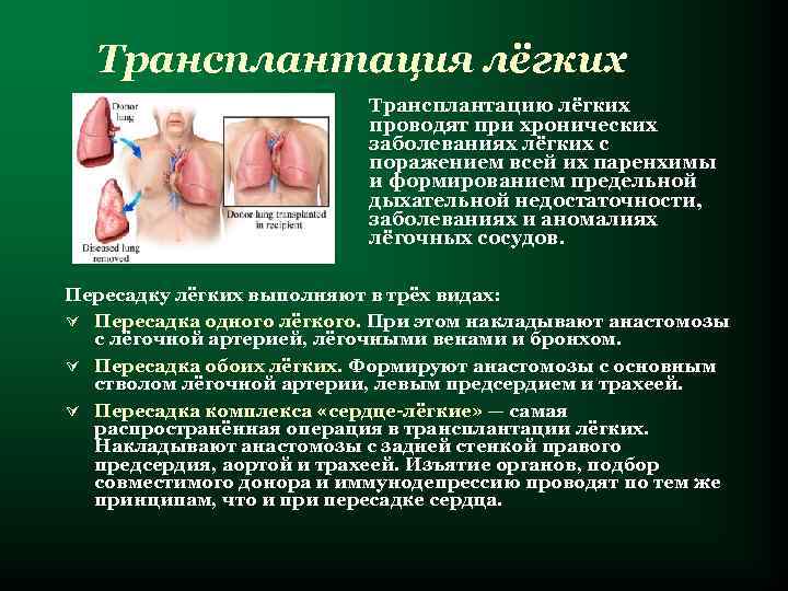  Трансплантация лёгких      Трансплантацию лёгких    