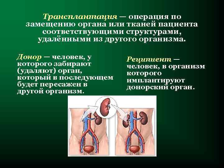  Трансплантация — операция по замещению органа или тканей пациента соответствующими структурами, удалёнными из