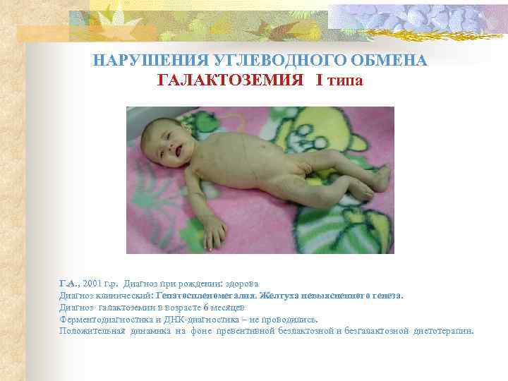   НАРУШЕНИЯ УГЛЕВОДНОГО ОБМЕНА   ГАЛАКТОЗЕМИЯ I типа Г. А. , 2001