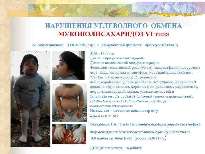  НАРУШЕНИЯ УГЛЕВОДНОГО ОБМЕНА   МУКОПОЛИСАХАРИДОЗ VI типа АР-наследование  Ген ARSB, 5