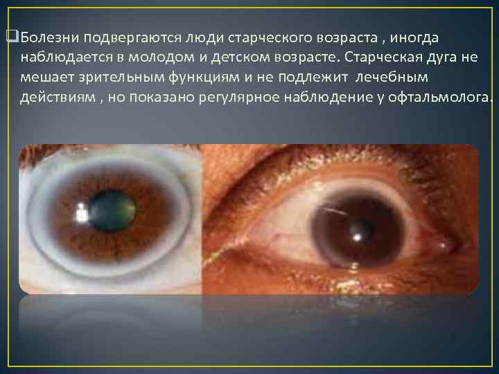 q. Болезни подвергаются люди старческого возраста , иногда наблюдается в молодом и детском возрасте.