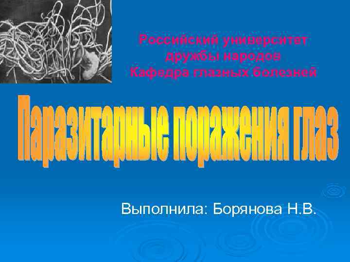  Российский университет дружбы народов Кафедра глазных болезней Выполнила: Борянова Н. В. 