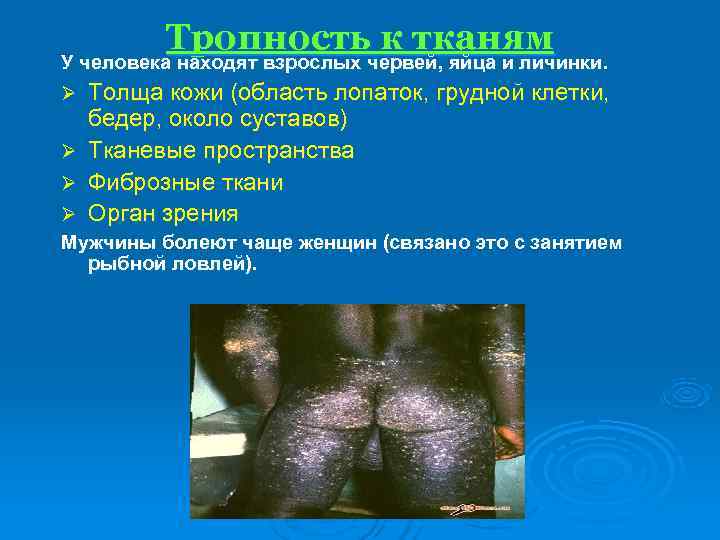    Тропность к тканям У человека находят взрослых червей, яйца и личинки.