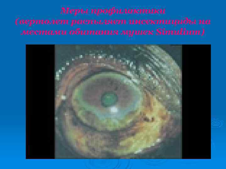   Меры профилактики (вертолет распыляет инсектициды на местами обитания мушек Simulium) 