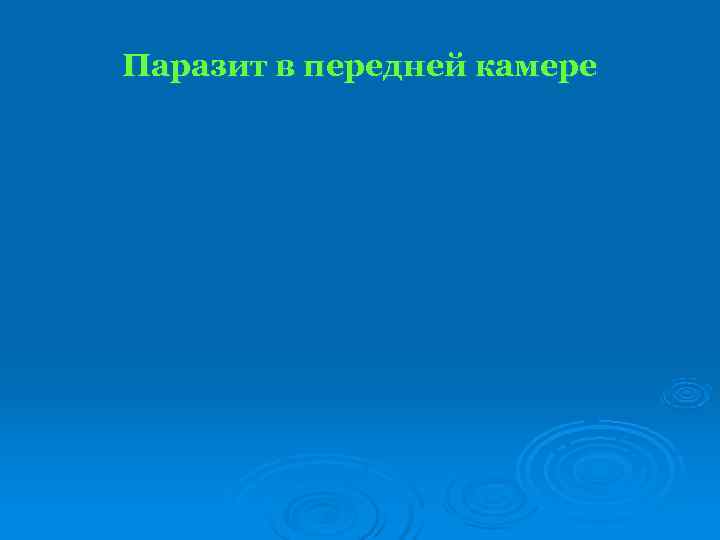 Паразит в передней камере 