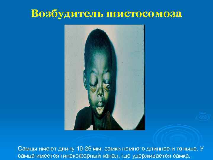   Возбудитель шистосомоза   Самцы имеют длину 10 -26 мм: самки немного