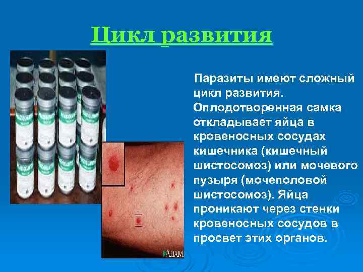 Цикл развития  Паразиты имеют сложный  цикл развития.   Оплодотворенная самка 