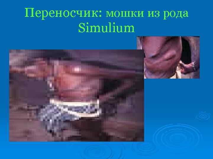 Переносчик: мошки из рода  Simulium 