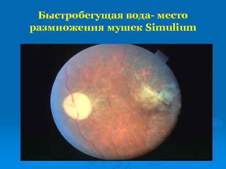  Быстробегущая вода- место размножения мушек Simulium 