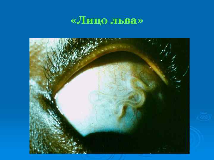  «Лицо льва» 