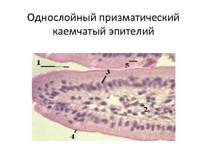 Однослойный призматический каемчатый эпителий 