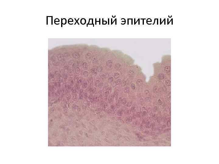 Переходный эпителий 