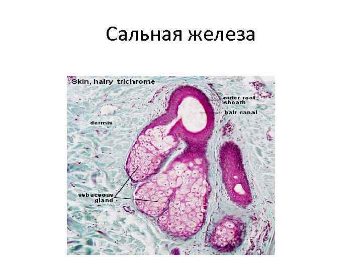 Закупоренная сальная железа фото