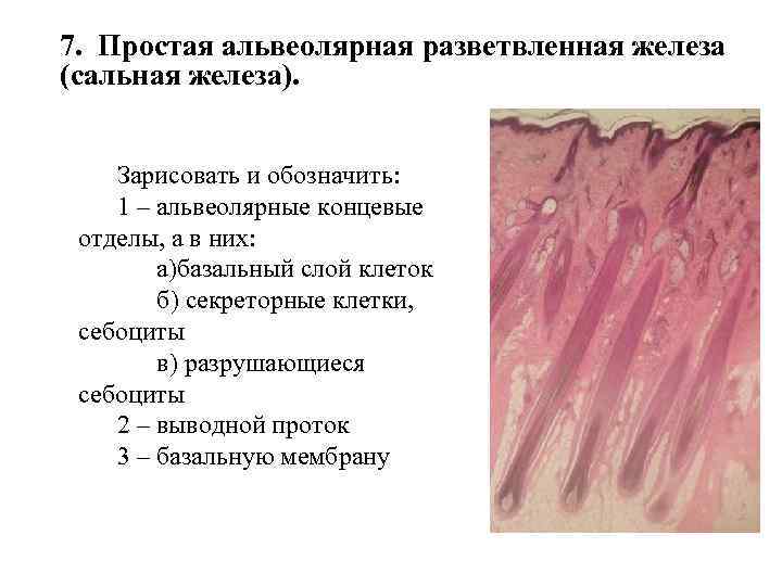 Закупоренная сальная железа фото