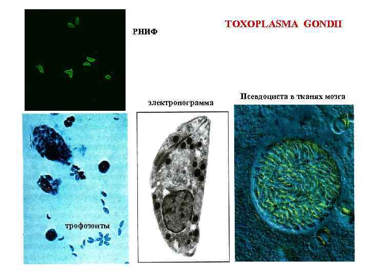 Токсоплазмы гонди. Токсоплазмоз микроскопия. Токсоплазма микробиология. Toxoplasma gondii под микроскопом.