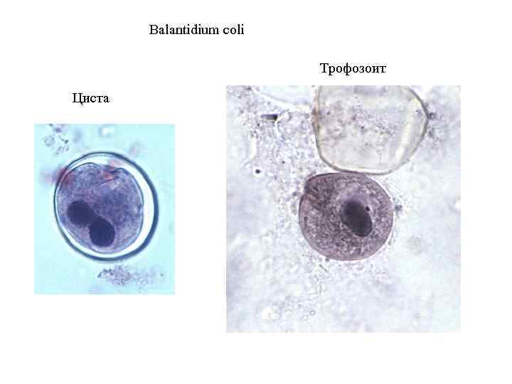 Бластоцисты в кале лечение. Balantidium coli под микроскопом. Balantidium coli, циста. Циста и трофозоит балантидий.