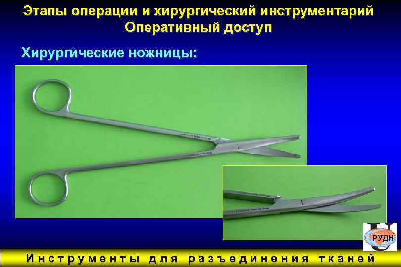 Этапы операции и хирургический инструментарий Оперативный доступ Хирургические ножницы: РУДН Инструменты для разъединения тканей