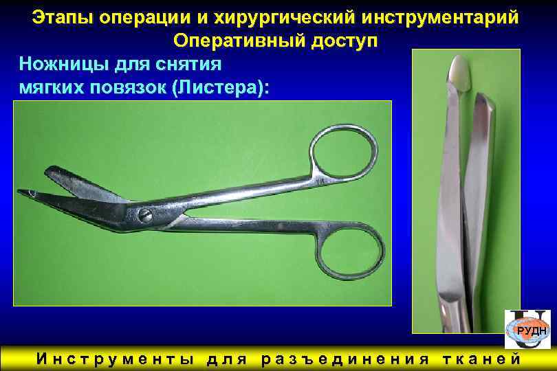 Этапы операции и хирургический инструментарий Оперативный доступ Ножницы для снятия мягких повязок (Листера): РУДН